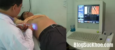 Các giải pháp phòng bệnh ung thư gan