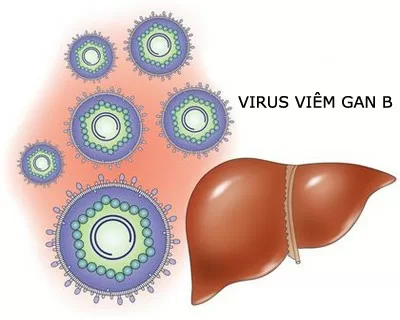 Các thể lâm sàng bệnh viêm gan B mãn tính