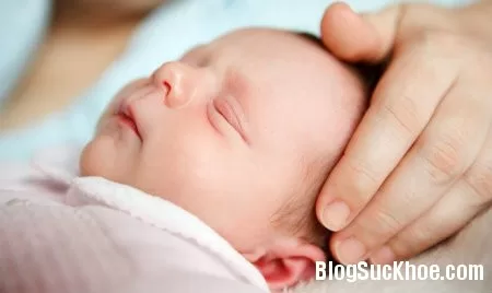 Phòng tránh bẹt đầu ở bé sơ sinh