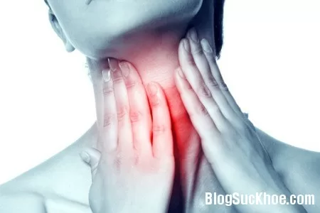 Những mẹo hay chữa viêm họng