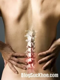 Nguyên nhân và cách điều trị đau lưng cột sống cuối