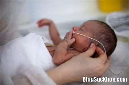Rối loạn tiêu hóa ở bé sinh non