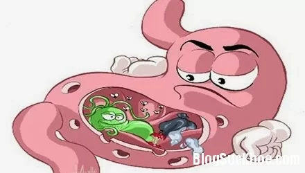 Nguyên nhân gây bệnh viêm dạ dày cấp tính