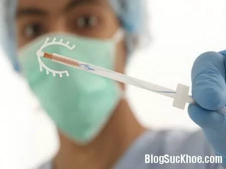Những biện pháp tránh thai phổ biến ở phụ nữ