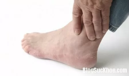 "Thủ phạm" đe dọa sức khỏe quý ông ngoại tứ tuần