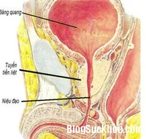 Các phương pháp điều trị phì đại tuyến tiền liệt