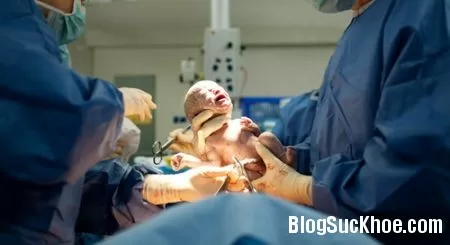 Ưu nhược điểm của đẻ mổ