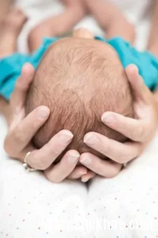 Cách phòng ngừa bẹt đầu ở trẻ sơ sinh
