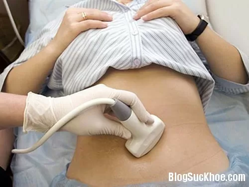 Bệnh u nang buồng trứng khi mang thai