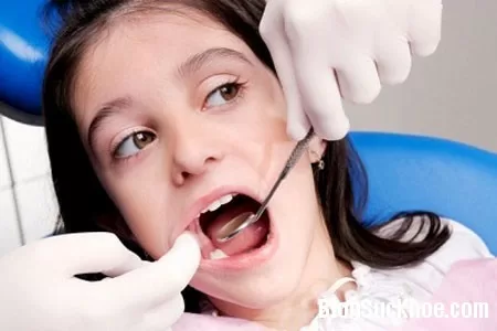 Điều trị bệnh sâu răng