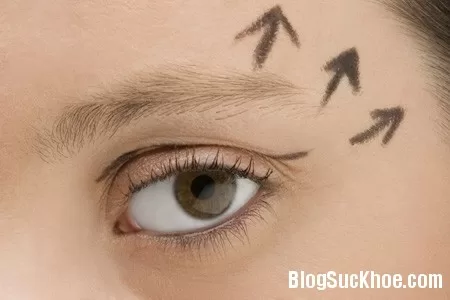 Những điều cần biết khi bấm mí mắt