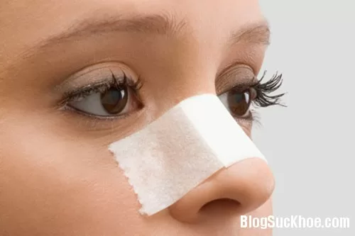 Thật hư miếng dán trị sẹo mụn