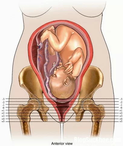Các giai đoạn khi mẹ bầu chuyển dạ