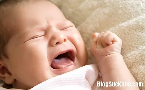 Cách phân biệt cặn sữa với tưa miệng ở trẻ
