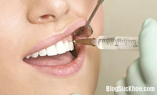 Nguyên nhân và biểu hiện của viêm tủy răng