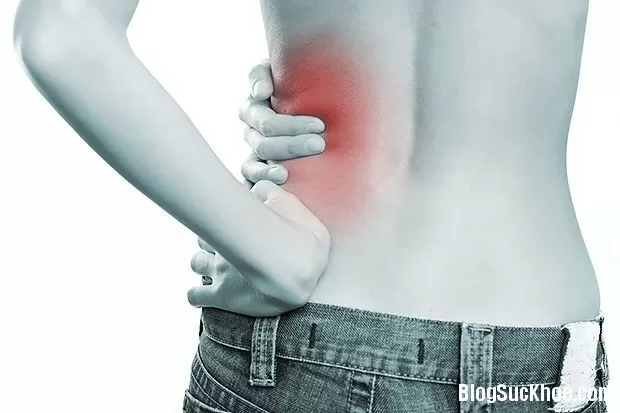 Những triệu chứng cơ bản của bệnh sỏi thận