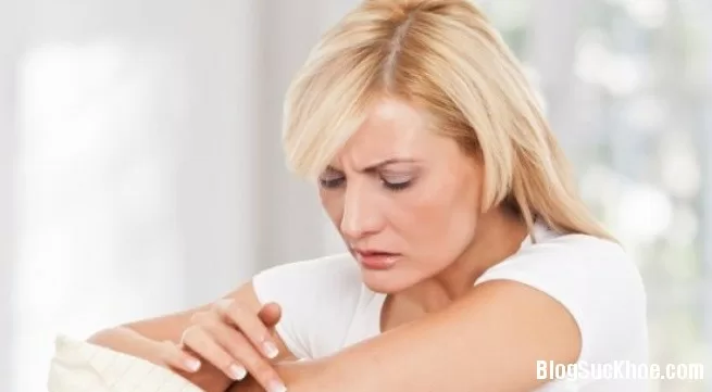 Các thể bệnh chàm thường gặp