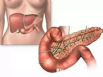 Cấp cứu cơn viêm tụy cấp tại nhà