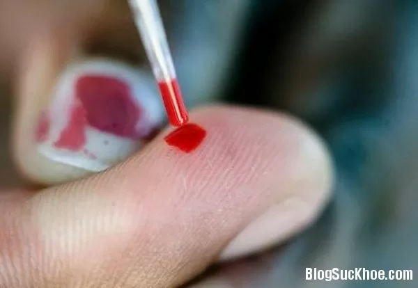 Mẹo xử lý khi không may có nguy cơ bị phơi nhiễm HIV
