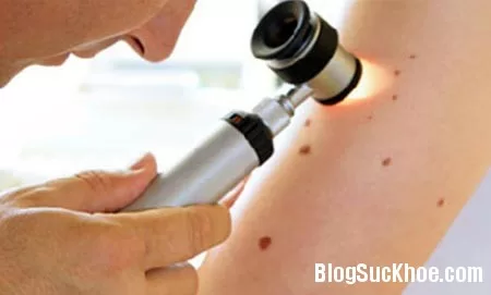 Các dấu hiệu cảnh báo ung thư sớm