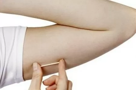 Những điều cần biết về cấy que tránh thai