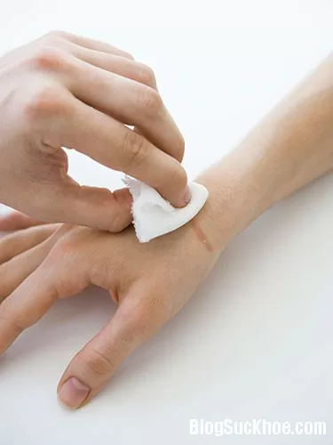 Những lưu ý khi sử dụng thuốc ngoài da
