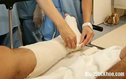 Phương pháp giúp xương nhanh liền