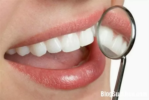 Những cách hay trị dứt bệnh viêm lợi