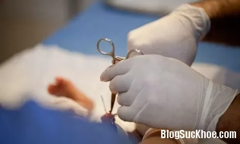 Những lời khuyên giúp cậu nhỏ bình phục sau khi cắt bao quy đầu