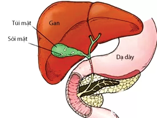 Nguyên nhân gây tắc nghẽn mật