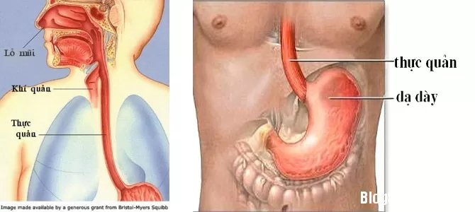 Những biểu hiện của ung thư thực quản