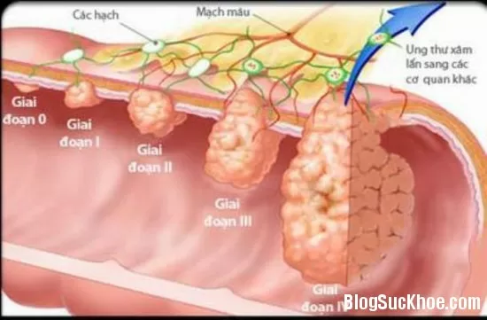 Bệnh gì không nên dùng vitamin?