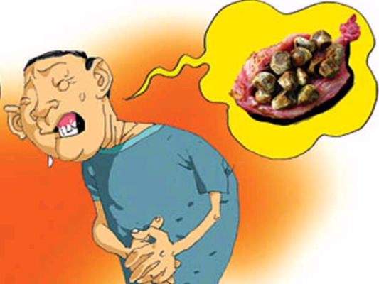 Chẩn đoán sớm bệnh sỏi túi mật