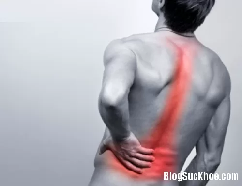 Điều trị gai cột sống