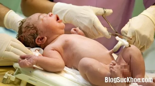 Chậm cắt dây rốn sau sinh: Lợi đủ đường!