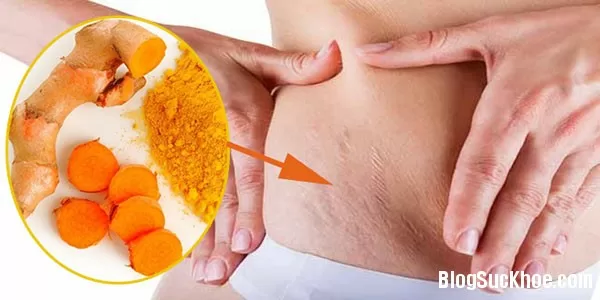 2 công thức trị rạn da tuyệt vời từ thiên nhiên