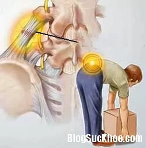 5 cách phòng ngưa đau lưng