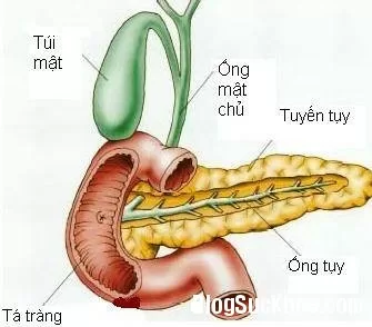 Biến chứng bệnh viêm tụy cấp