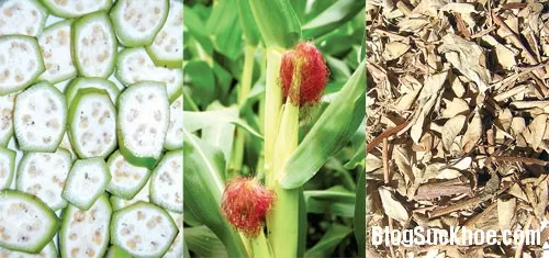 Bài thuốc chữa sỏi đường tiết niệu