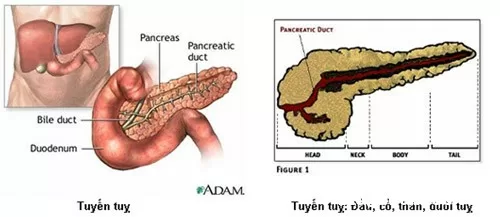 Điều trị viêm tụy cấp nặng theo hướng mới