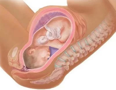 Những hình ảnh em bé ra khỏi bụng mẹ khi sinh thường