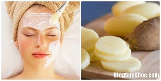 Khoai tây - bí quyết làm đẹp thần kỳ