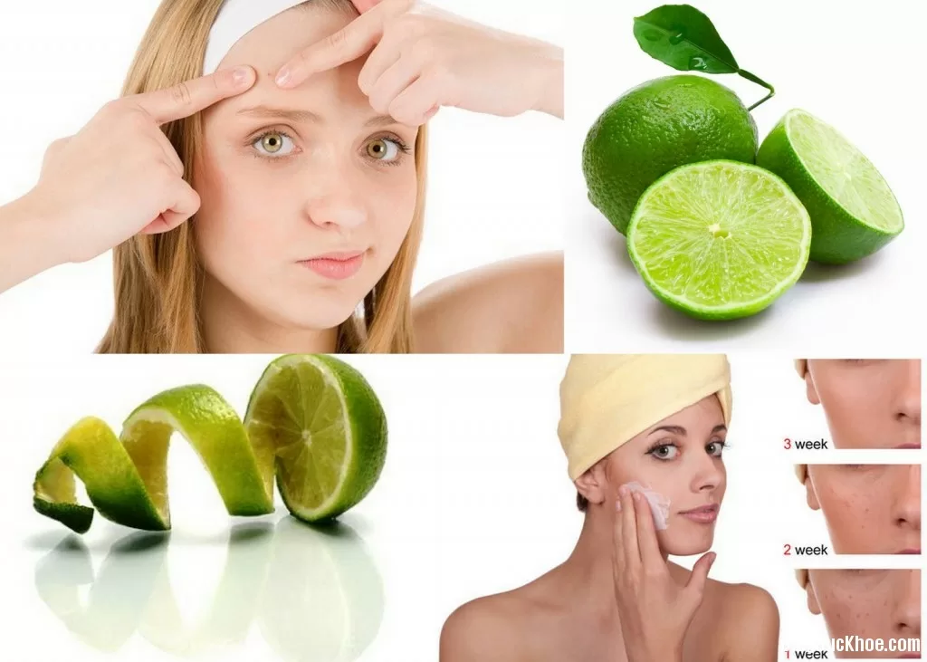 Đặc trị mụn trứng cá với nước cốt chanh
