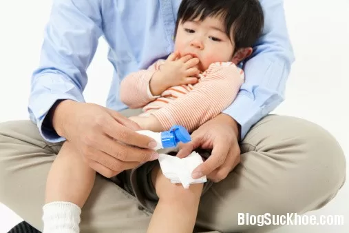 Cách sơ cứu ngay tại chỗ khi bị chó cắn