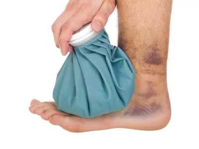 Mẹo nhỏ đánh tan vết thâm tím xấu xí