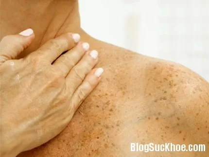 Những dấu hiệu của bệnh vặt nhưng cần đi khám