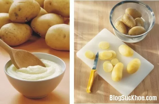 Chữa thâm nách và vùng kín hiệu quả với khoai tây