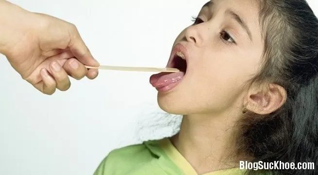 Điều trị viêm lợi, nhiệt miệng nhanh khỏi cho trẻ