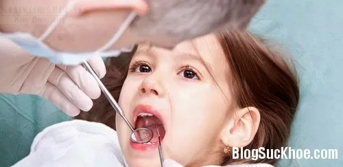 Bệnh răng miệng trẻ dưới 3 tuổi thường gặp