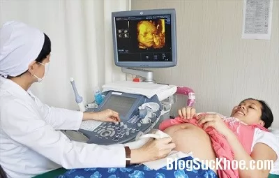 Phát hiện sớm dị tật thai nhi
